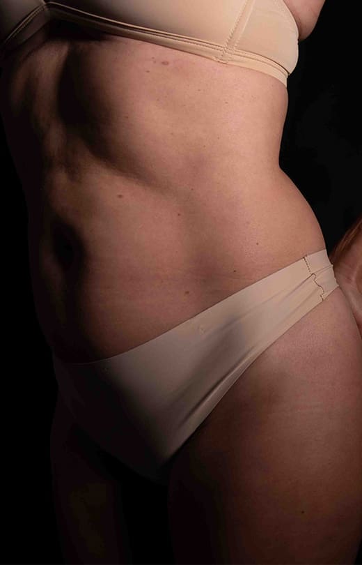 Close-up side view of a woman’s abdomen and hip showing toned, natural contours.